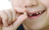 Trẻ mọc răng và thay răng cần lưu ý gì?