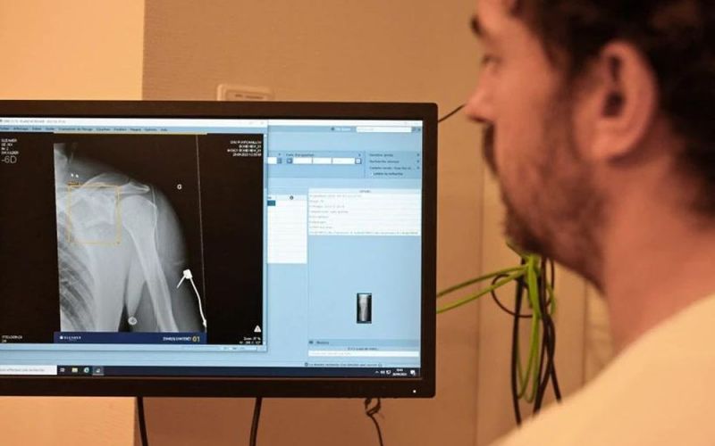 Nga mở rộng ứng dụng trí tuệ nhân tạo trong chẩn đoán hình ảnh X-quang